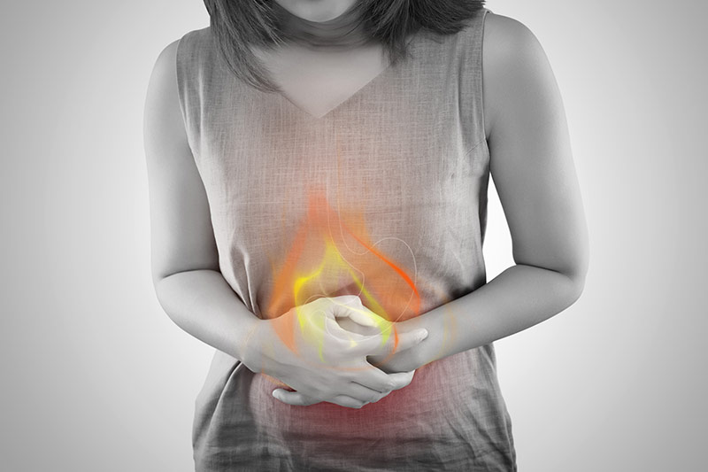 Acid Reflux Clinical Study