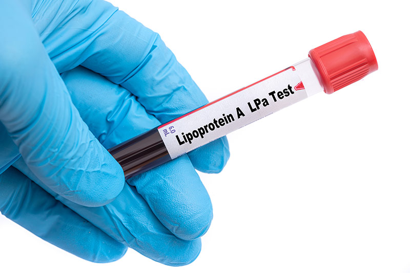 Lipoprotein Clinical Study Lipoprotein Clinical Study