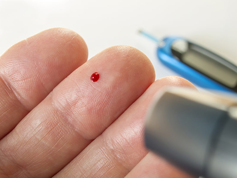 Obesity-w-Type-II-Diabetes Obesity w/ Type II Diabetes